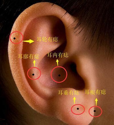 耳垂上有痣|耳朵长痣的位置图解 耳朵长痣的位置图解有福气